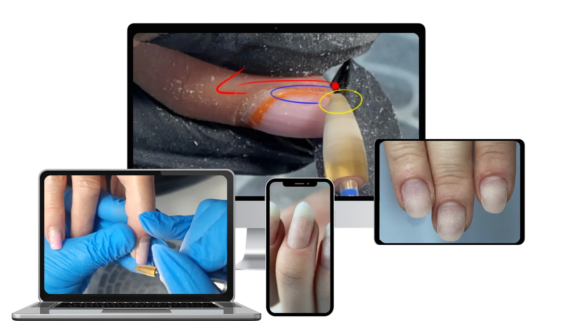 Refill Removal Pro cursus